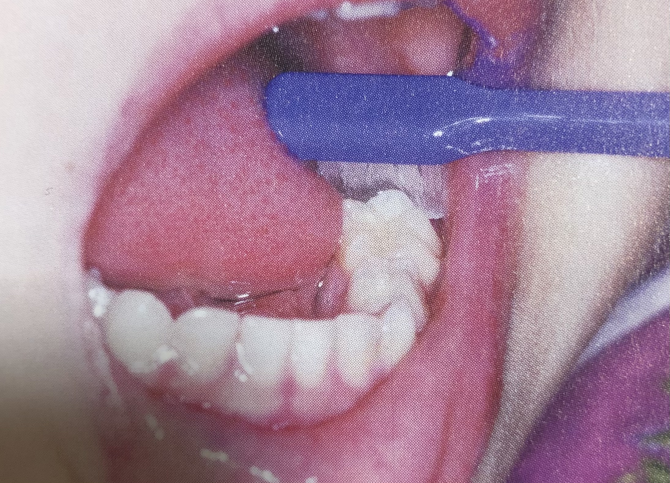 6歳の歯磨き🌈⑦ 画像01