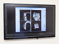 歯科用CTを活用し、安全・確実な根管治療を