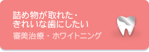 詰め物が取れた・きれいな歯にしたい審美治療・ホワイトニング