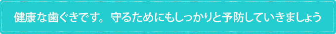 健康な歯ぐきです。守るためにもしっかりと予防していきましょう