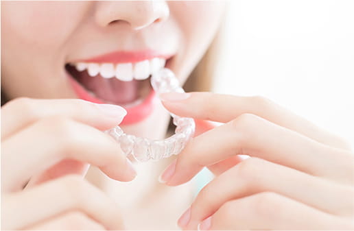 invisalign