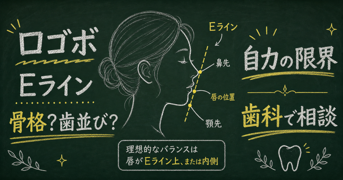 口ゴボ・Eラインの治し方｜自力改善の限界と歯科医師が教える正解