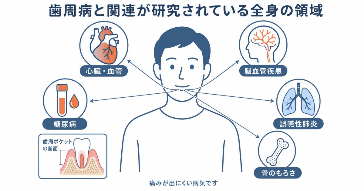 歯周病菌が血管を通り心臓病や動脈硬化を引き起こす仕組み